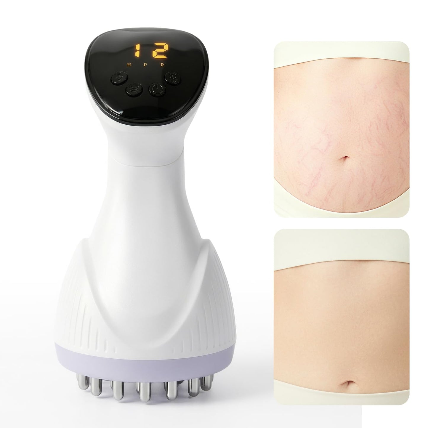MMGJMP Lymphatic Drainage Massager & Anti-Cellulite Massage Tool, Body Contouring Device for Legs, Arms & Stomach, Supports Smoother Skin, with Gentle Warming & Vibration - W MMGJMP buy supplements Au