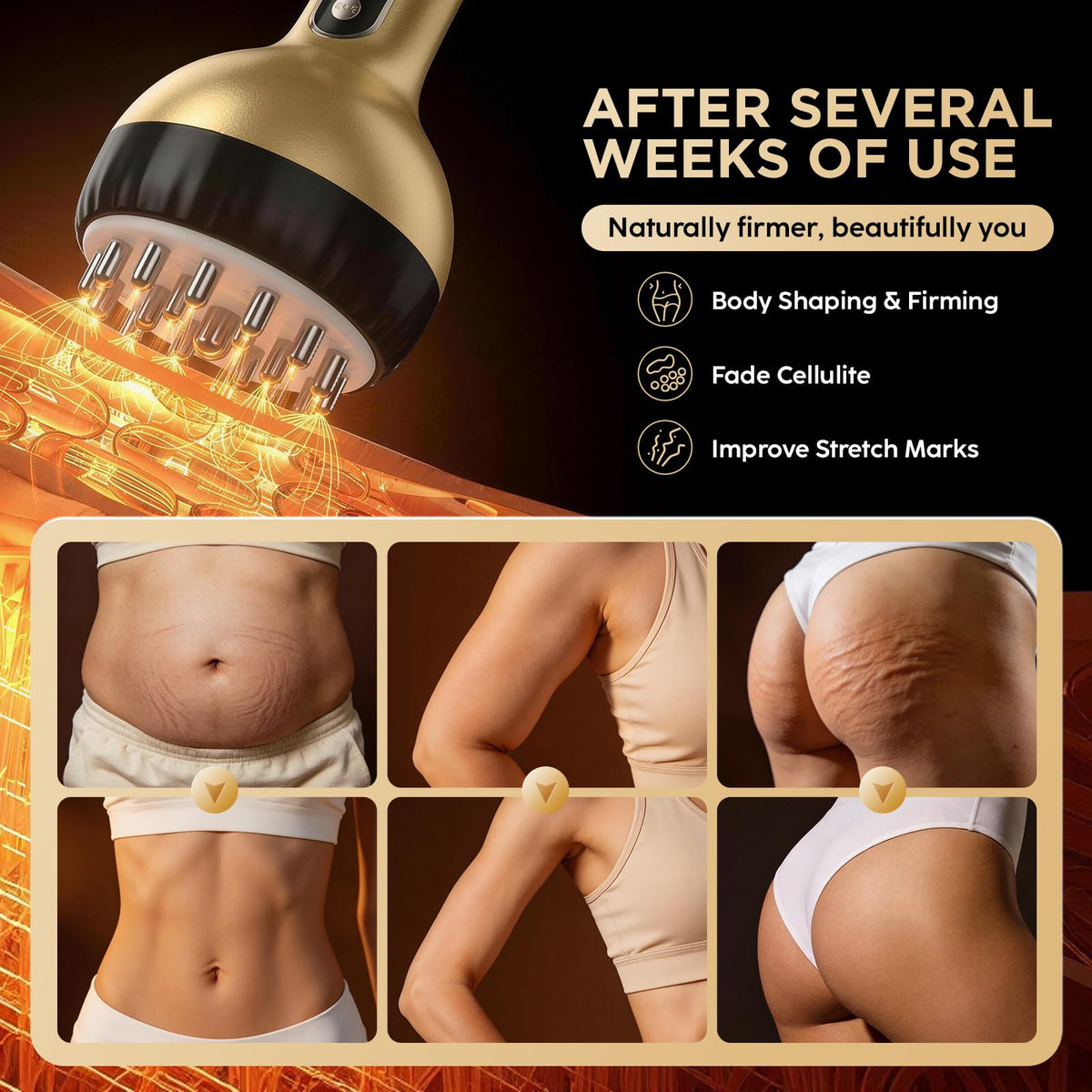 OVGIAP Lymphatic Drainage Massager & Anti-Cellulite Massage Tool, Body Sculpting Device for Legs, Arms & Stomach, Supports Smoother Skin, with Gentle Warming & Vibration - Gold OVGIAP buy supplements Au