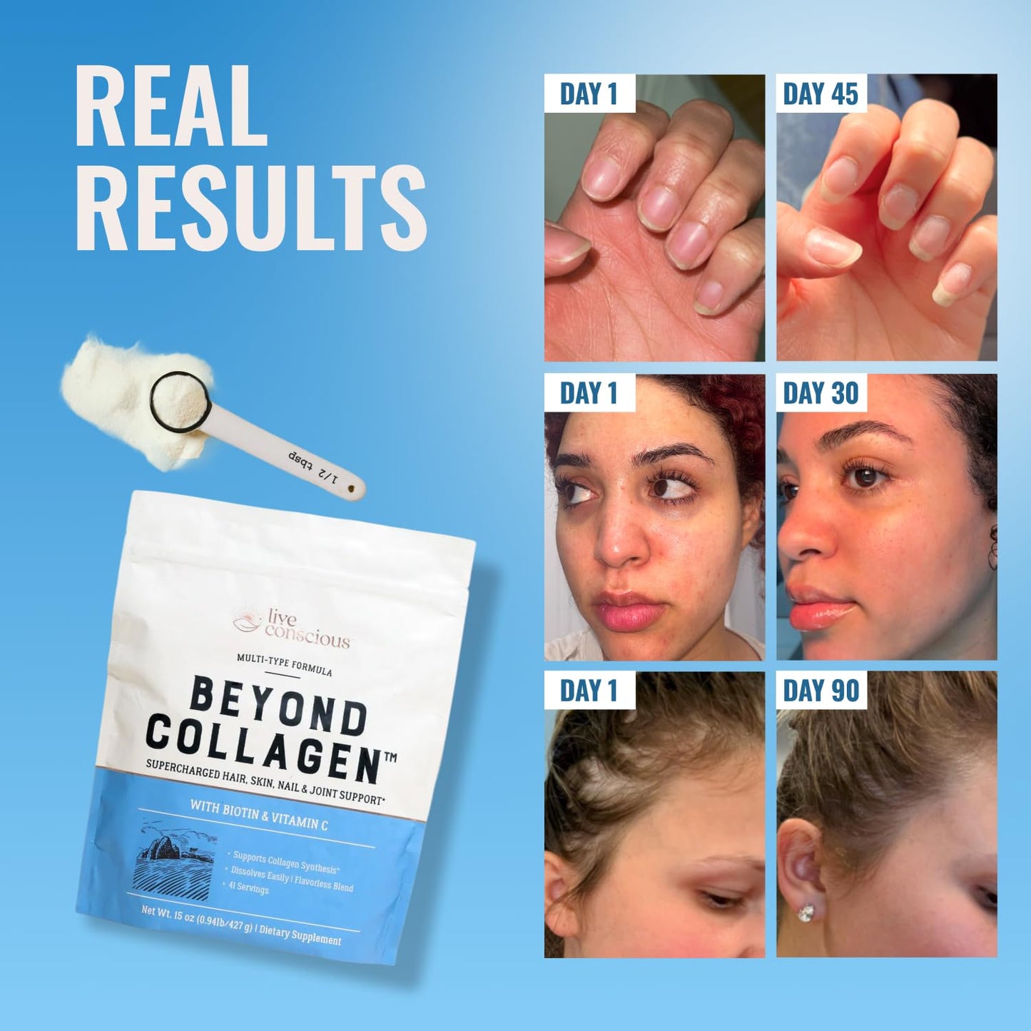 Live Conscious Beyond Collagen Multi Collagen Powder for Women w/Types I, II, III, V & X - Keto Friendly, Hydrolyzed Collagen Peptides Powder Blend w/Biotin & Vitamin C 41 Servings Live Conscious buy supplements Au