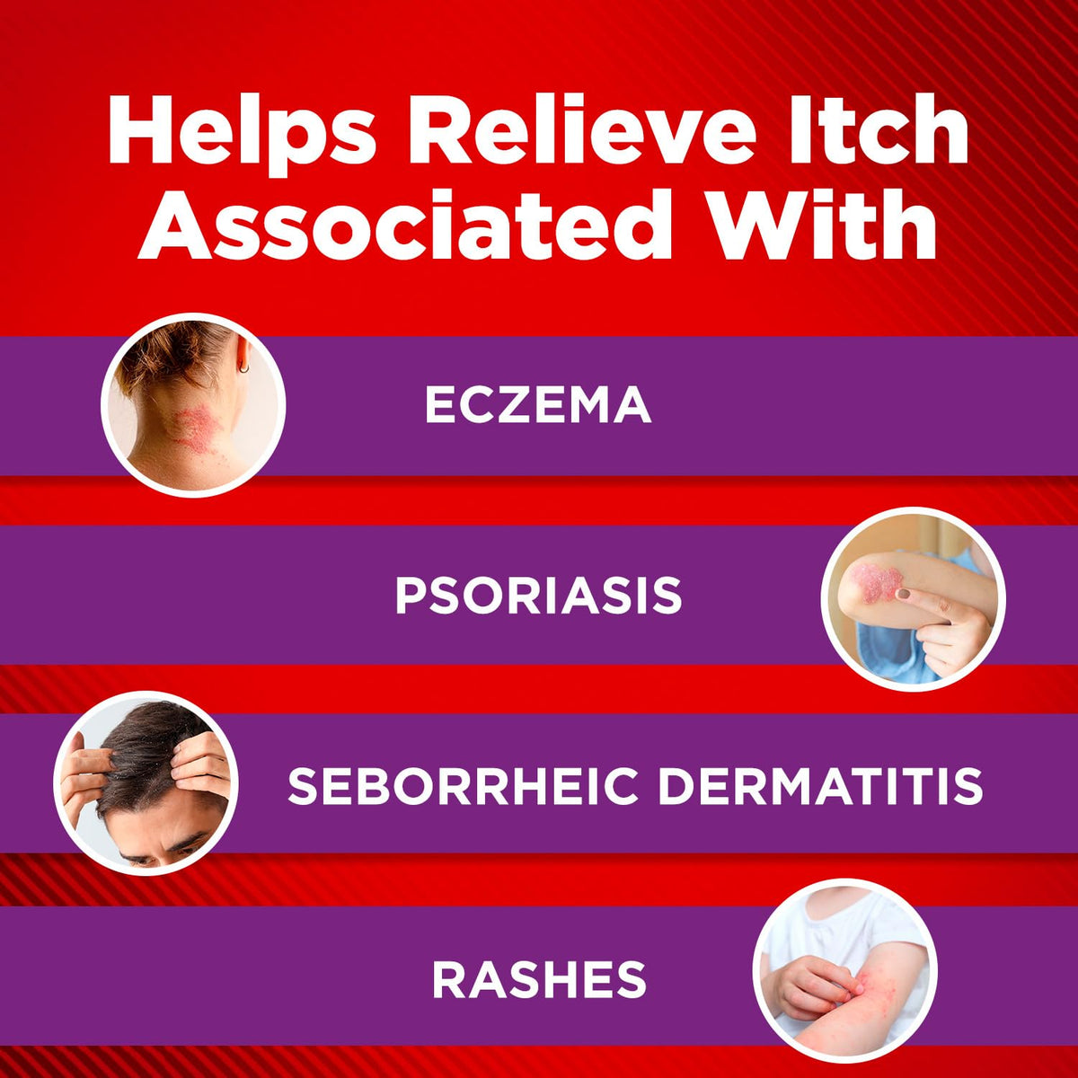 Cortizone-10 Maximum Strength Intensive Healing Itch Relief Lotion for Eczema, 1% Hydrocortisone, Fast-Acting, Anti-Itch Cream for Minor Skin Irritations, Rashes and Inflammation Due to Eczema, 3.5 oz Cortizone 10Buy Supplements Australia