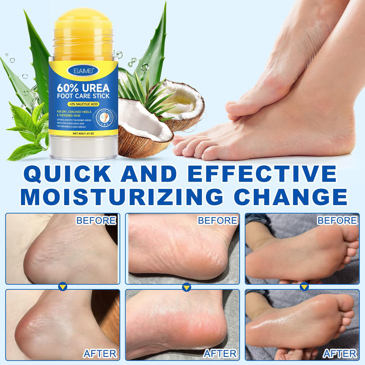 FANSHI 2 PCS Urea Stick 60% High Potency, Foot Care Urea Stick for Deeply Moisturizing & Fast Absorbing, Exfoliation for Dry Cracked Heels & Thickened Skin