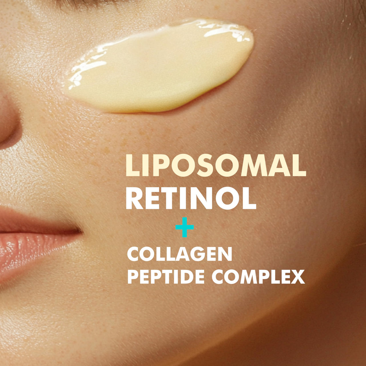 Ebanel 30% AHA 2% BHA Chemical Peel & 2.5% Retinol Cream Moisturizer for Face - Removes Acne Scars, Dark Spots, Wrinkles & Brightens Skin