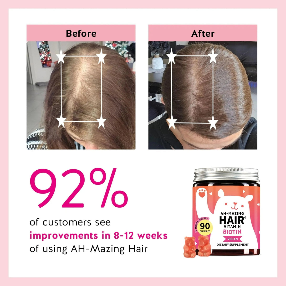 Biotin Gummies for Hair, Skin & Nails. 5,000 mcg High Potency Vegan Vitamins for Faster Hair Growth, Stronger Nails & Healthy Skin. with Vitamins C & E, 90 Gummies - PrimeBioHealth - canada supplements