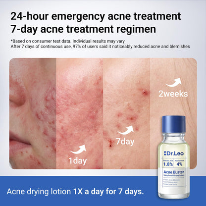 Dr.Leo 1.8% Salicylic Acid Spot Serum, Acne Treatment for Acne-Prone Sensitive Skin | Niacinamide, Fast Pimple Relief, Fades Acne Marks - PrimeBioHealth - canada supplements