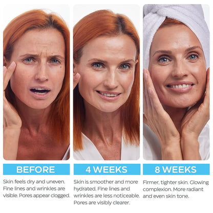 Retinol Cream for Face with Hyaluronic Acid, Day-Night Anti-Aging Moisturizer for Women, Men, Collagen Cream for Face Reduces Wrinkles, Dryness, 1.85 Oz - PrimeBioHealth - canada supplements