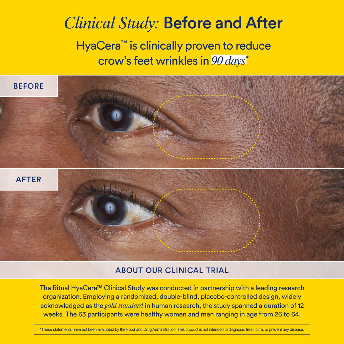 Ritual Hyaluronic Acid Skin Supplement - With Hyabest® and Ceratiq® - HyaCera Clinically Proven to Reduce Wrinkles, Fine Lines & Improve Skin Smoothness - PrimeBioHealth - canada supplements