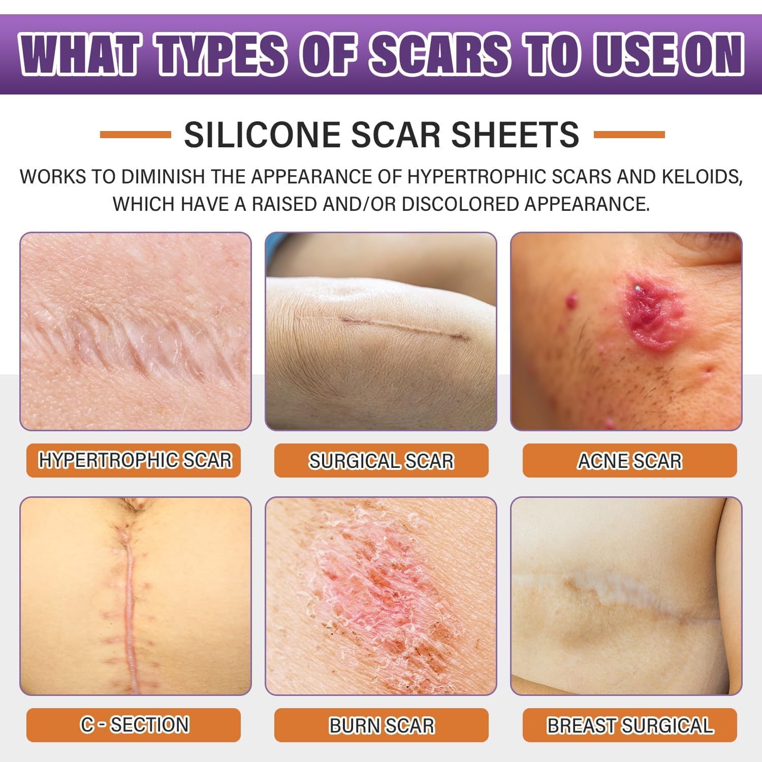 Silicone Scar Sheets,Silicone Scar Tape,Silicone Scar Removal Strips for Surgical,C-Section,Tummy Tuck,Keloid Scars - PrimeBioHealth - canada supplements