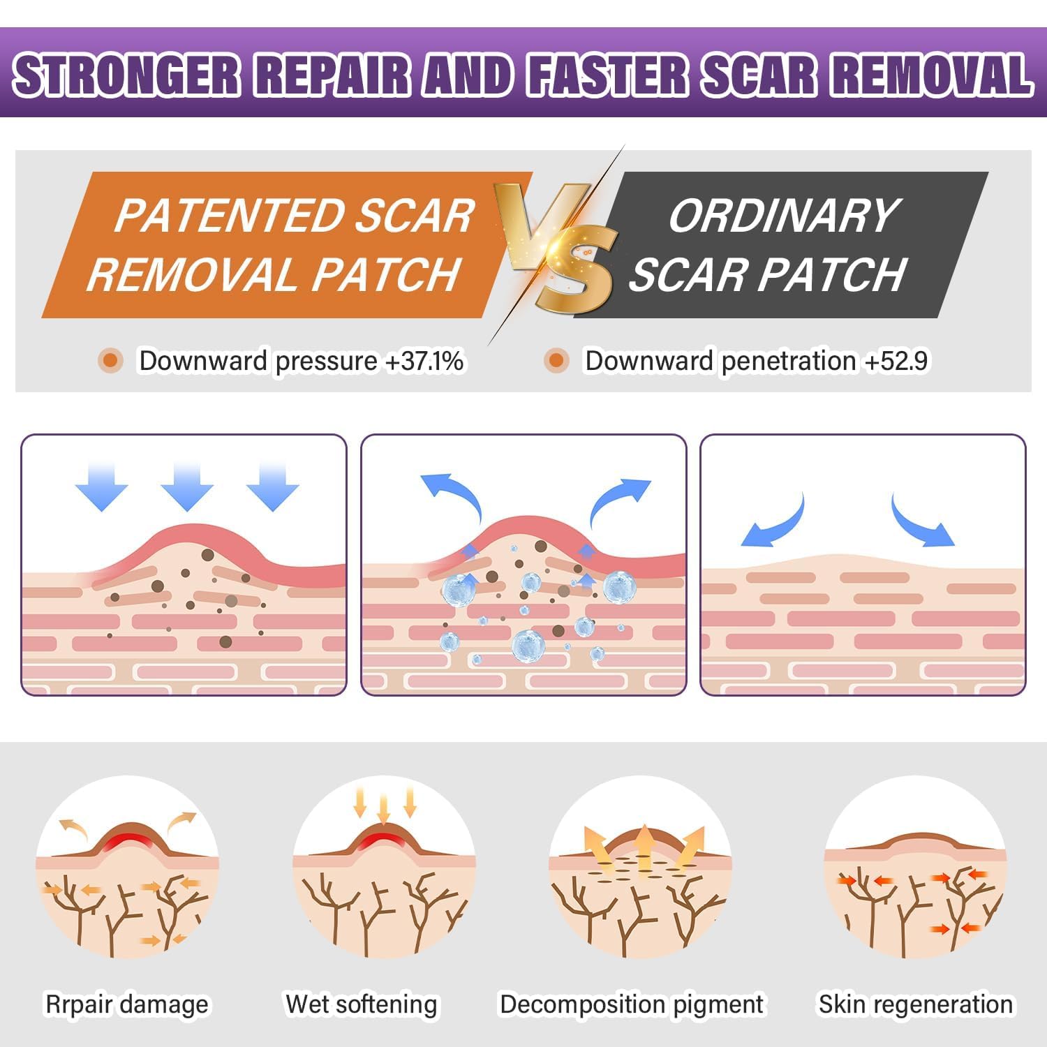 Silicone Scar Sheets,Silicone Scar Tape,Silicone Scar Removal Strips for Surgical,C-Section,Tummy Tuck,Keloid Scars - PrimeBioHealth - canada supplements