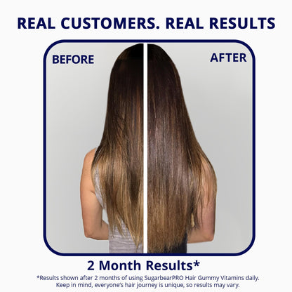 Sugarbear Hair Vitamin Gummy 2 Month Supply Extra Strength Biotin 6000mcg, Growth for Men & Women, Vegan Vitamin B12, MSM, Inositol, Omega 3, Elderberry, Certified Kosher, Halal, Cruelty-Free - PrimeBioHealth - canada supplements