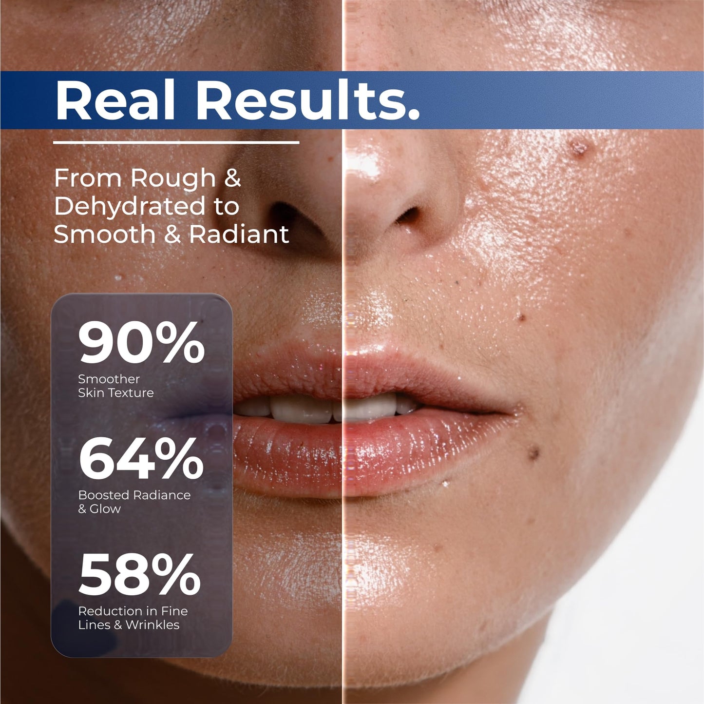 TURMSKIN® Hyaluronic Acid Serum Ampoules [ULTRA HYDRATING VIALS] - 3% Hyaluron Booster for Glass Skin & Anti Aging - 24 Hours Hydration - PrimeBioHealth - canada supplements