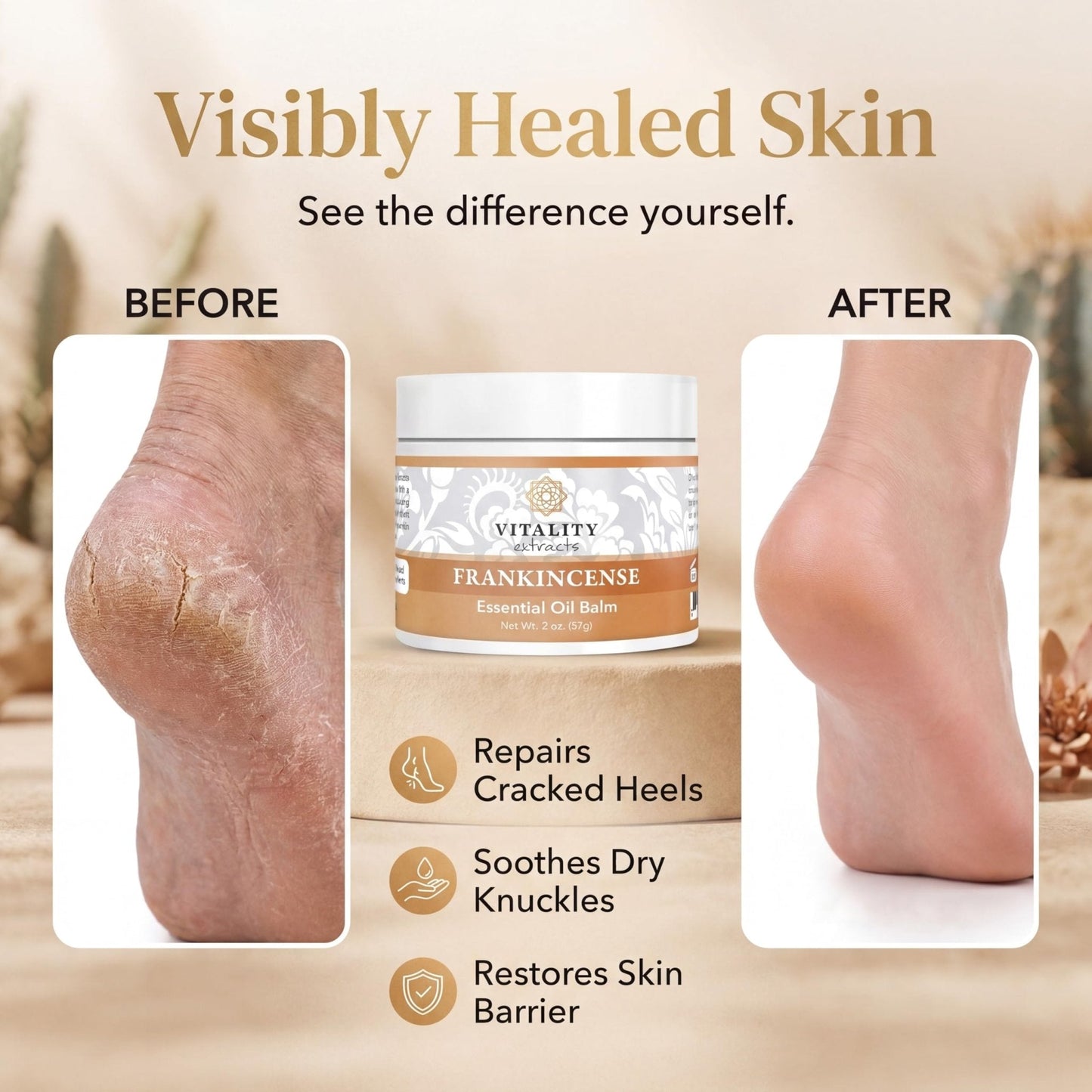 Vitality Extracts Frankincense Balm - 2oz, Boswellia Serrata, Beeswax, Olive Oil, Moisturizer for Dry, Cracked Skin, All Skin Types - PrimeBioHealth - canada supplements