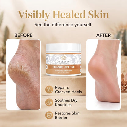 Vitality Extracts Frankincense Balm - 2oz, Boswellia Serrata, Beeswax, Olive Oil, Moisturizer for Dry, Cracked Skin, All Skin Types - PrimeBioHealth - canada supplements